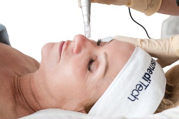 How to Choose a Microneedling Pen: Needle Count, Depth, Gauge and Speed